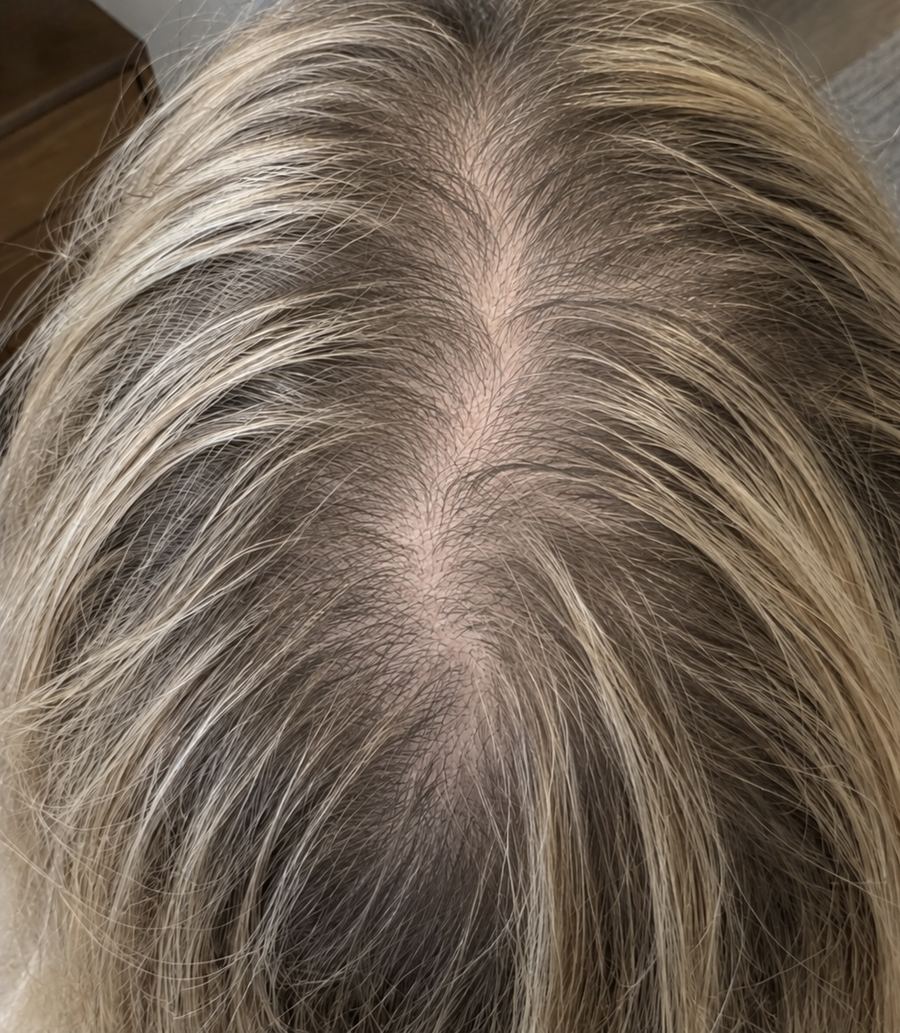 After 90 days