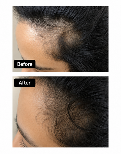 Kaminomoto Super Strength Hair Serum Gold — Daily Scalp Treatment for Thinning Hair